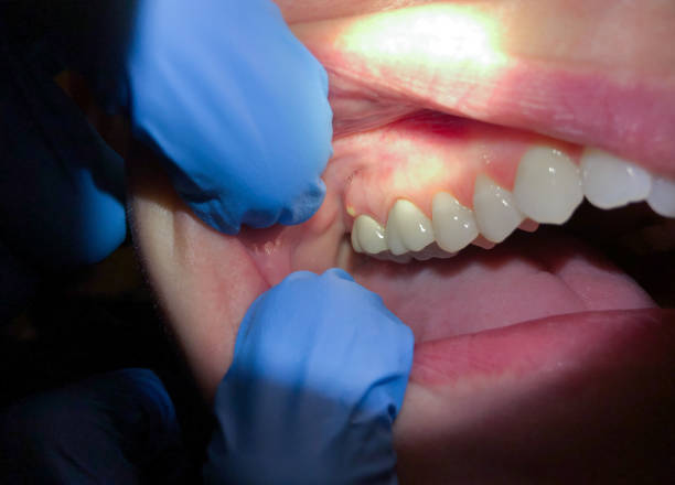 Best Emergency Dental Surgery in Lebanon South, PA